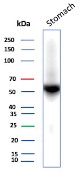 Carbonic Anhydrase IX/CA9 Antibody (rCA9/9937) - Azide and BSA Free