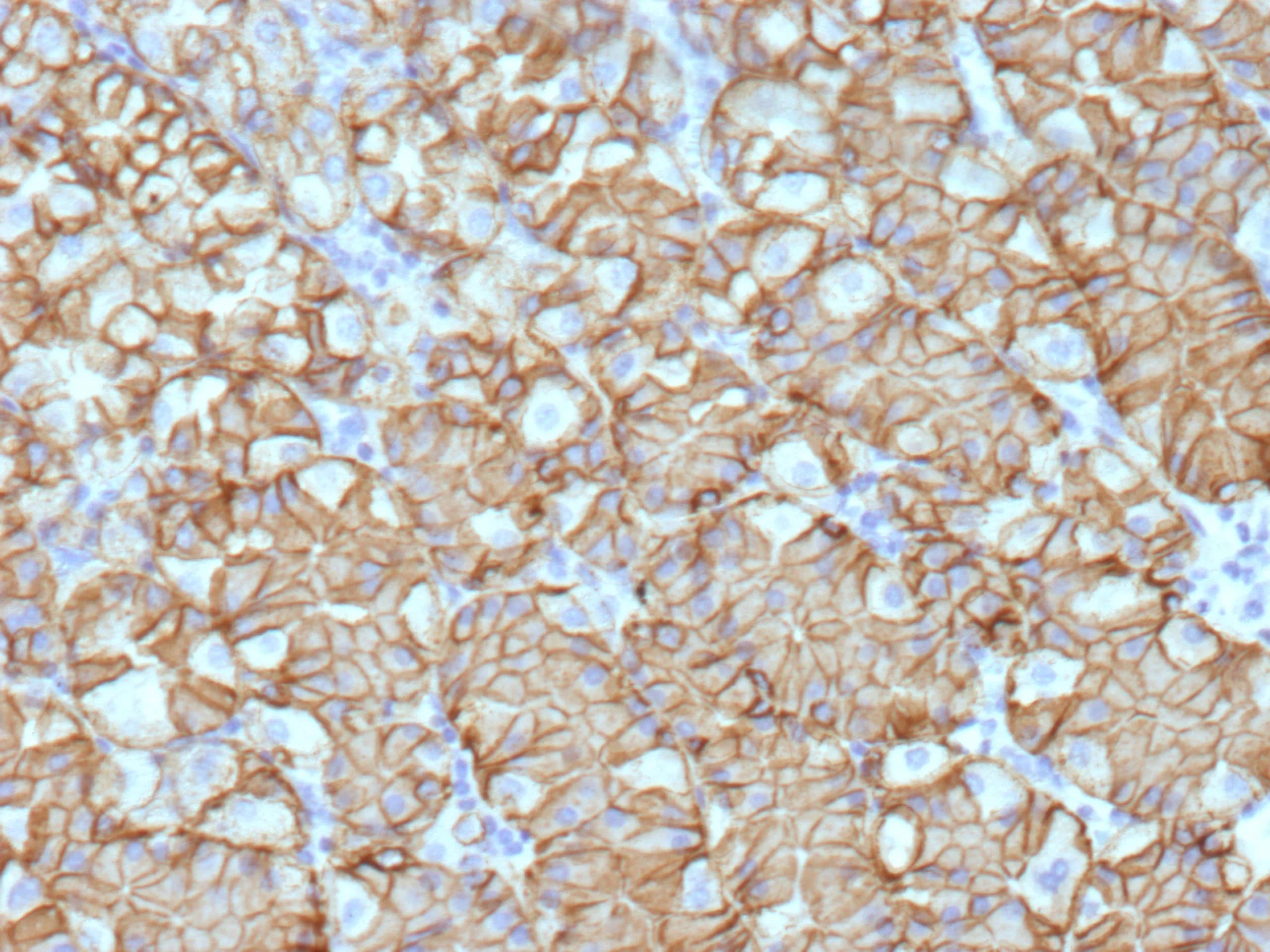 Carbonic Anhydrase IX/CA9 Antibody (CA9/9621R) - Azide and BSA Free