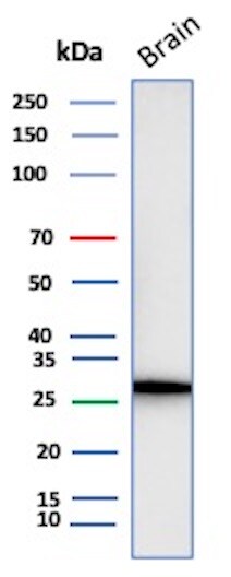 Calretinin Antibody (CALB2/4688R) - Azide and BSA Free