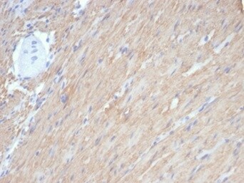 Caldesmon/CALD1 Antibody (rCALD1/7266) - Azide and BSA Free
