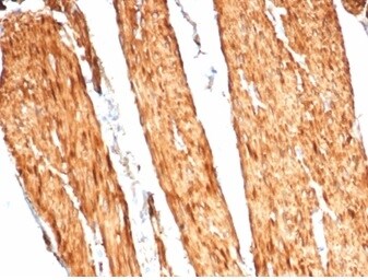 Caldesmon/CALD1 Antibody (CALD1/7024R) - Azide and BSA Free