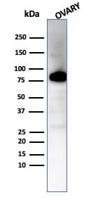 Caldesmon/CALD1 Antibody (CALD1/7024R) - Azide and BSA Free