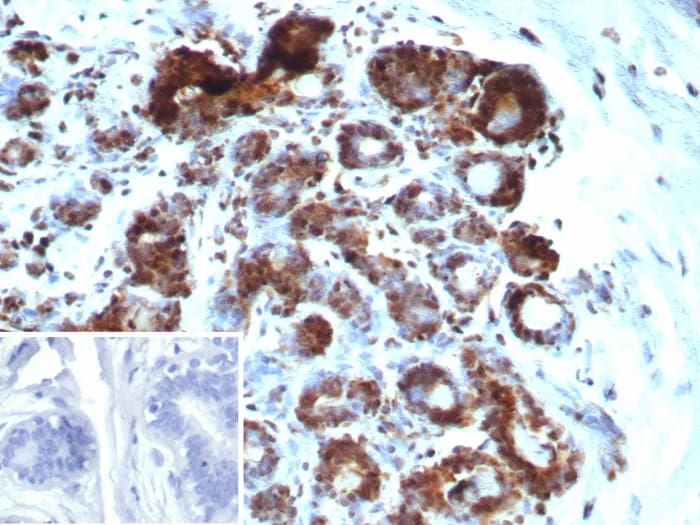 BAP1 Antibody (BAP1/9120R) - Azide and BSA Free