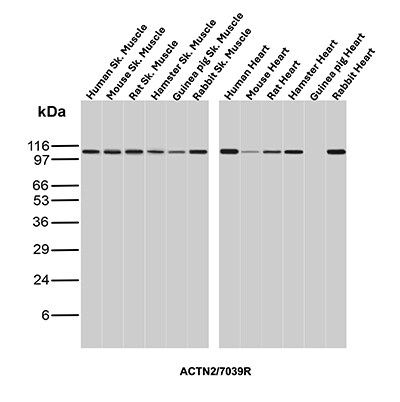 Alpha Actinin 2 Antibody (ACTN2/7039R) - Azide and BSA Free