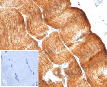 Alpha Actinin 2 Antibody (ACTN2/7041R) - Azide and BSA Free
