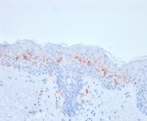 CD1a Antibody (rC1A/711) - Azide and BSA Free