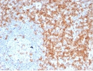 CD5 Antibody (C5/6463R) - Azide and BSA Free