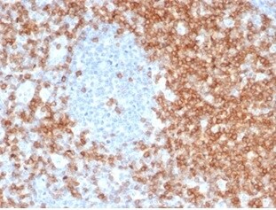 CD5 Antibody (C5/6463R) - Azide and BSA Free