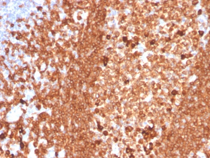 CD79A Antibody (IGA/3939R) - Azide and BSA Free