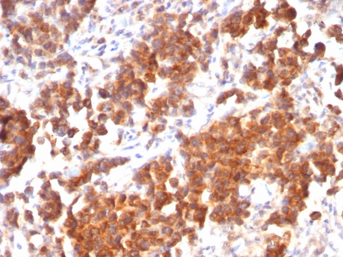 TL1A/TNFSF15 Antibody (rVEGI/1283) - Azide and BSA Free