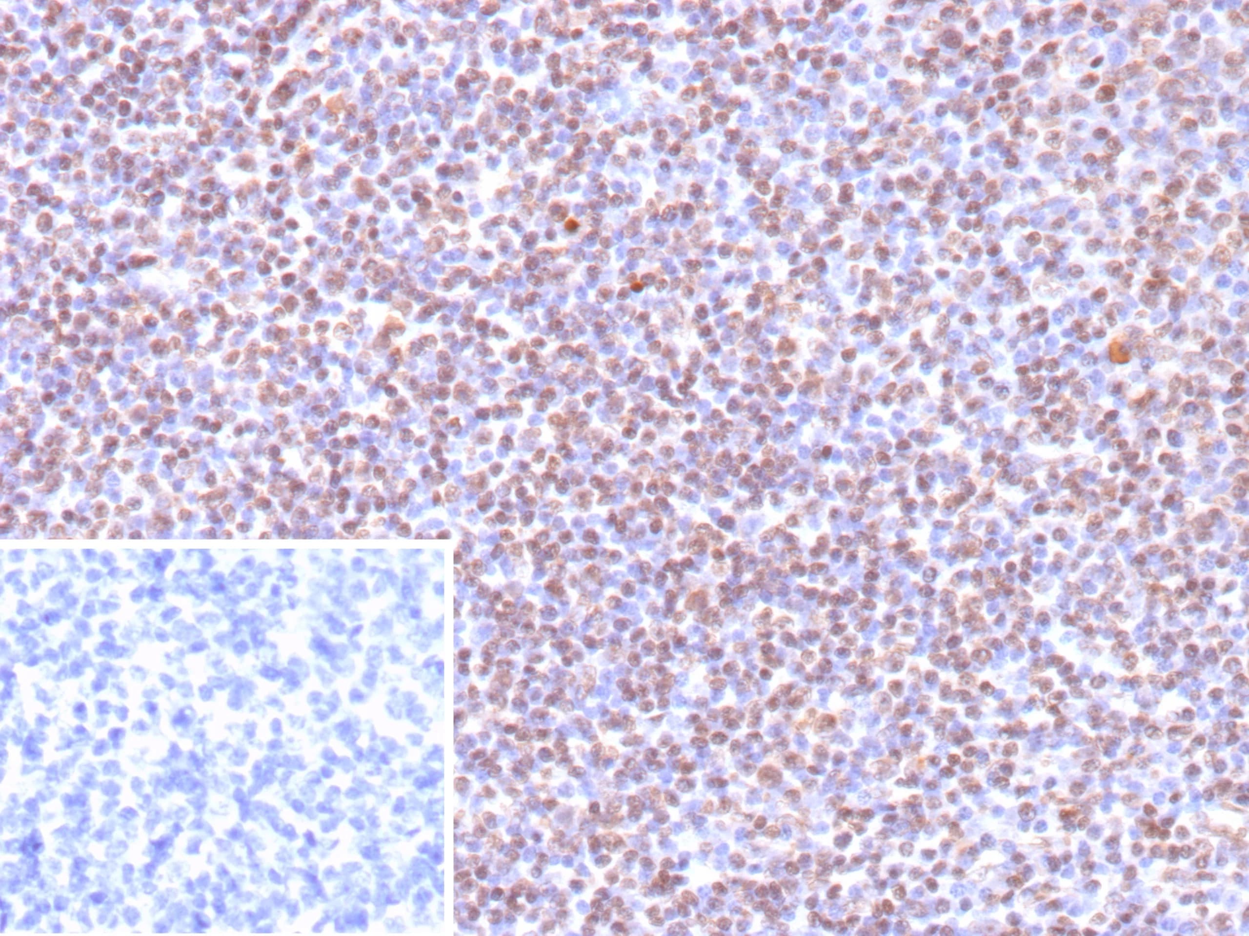 Epstein Barr Virus Antibody (EBV/9619R) - Azide and BSA Free