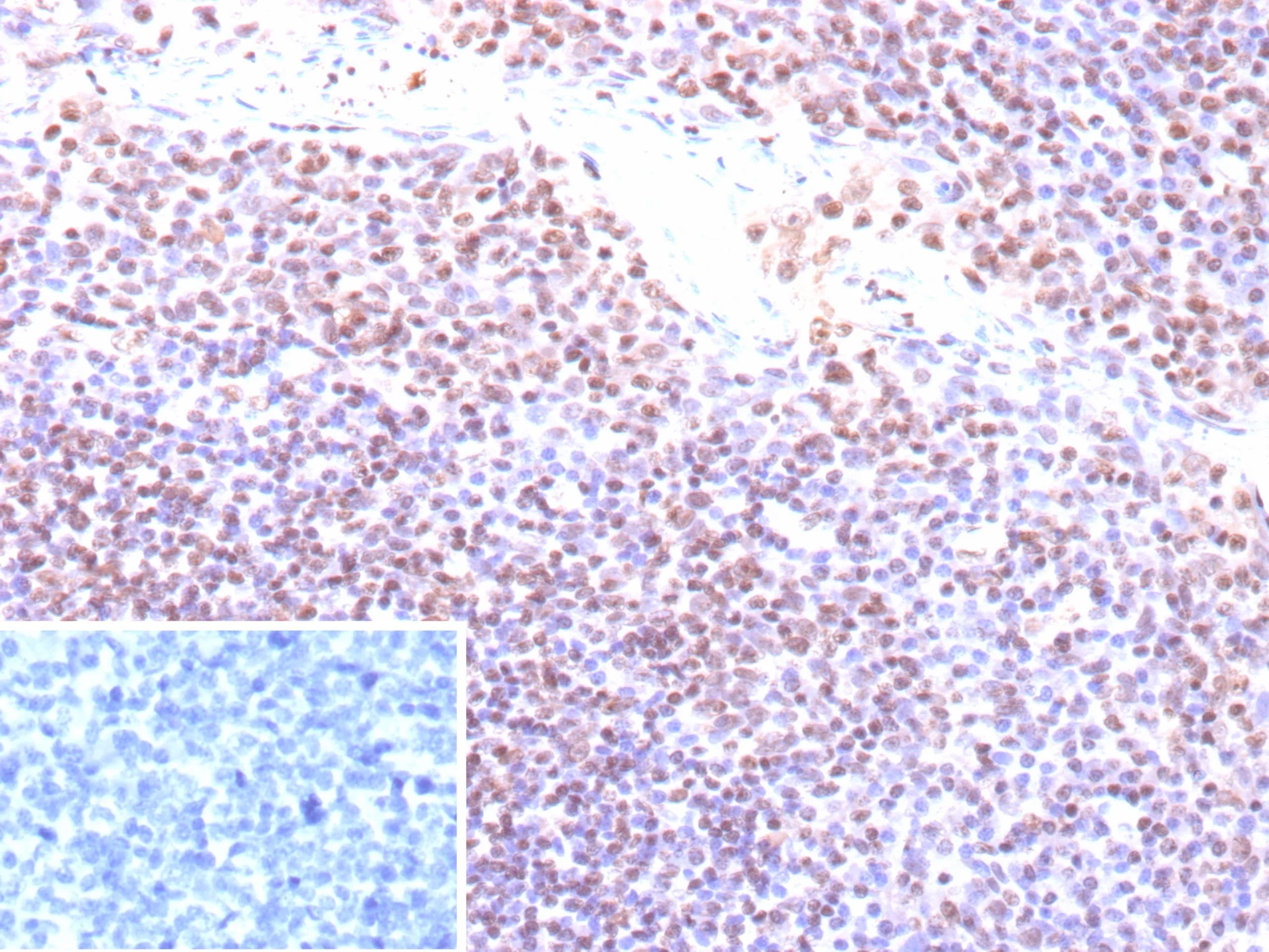 Epstein Barr Virus Antibody (EBV/9620R) - Azide and BSA Free