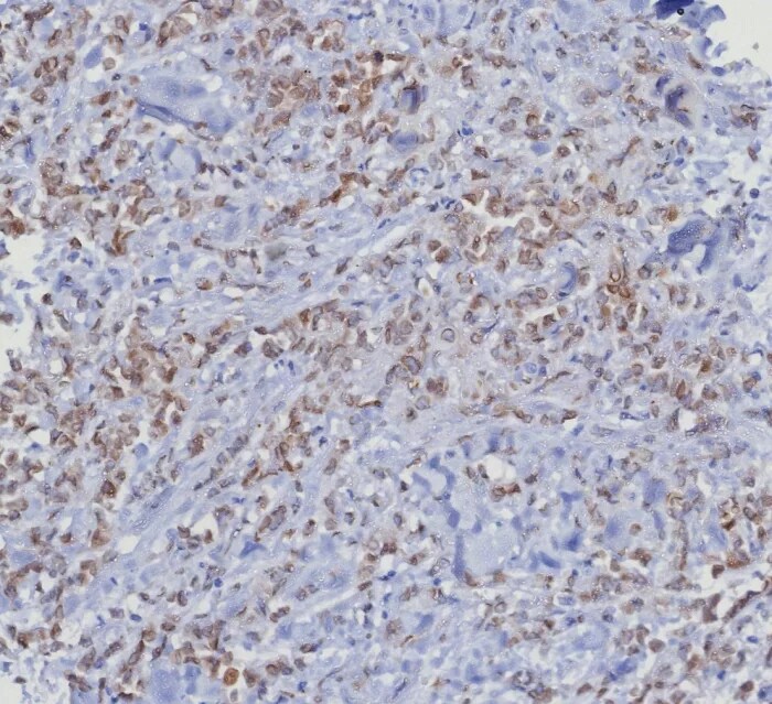 CDK4 Antibody (CDK4/8351R) - Azide and BSA Free
