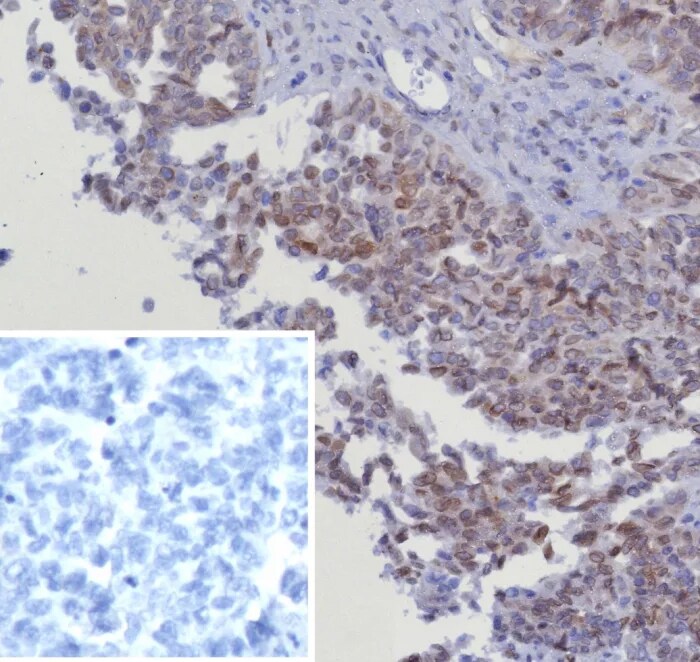 CDK4 Antibody (CDK4/8351R) - Azide and BSA Free