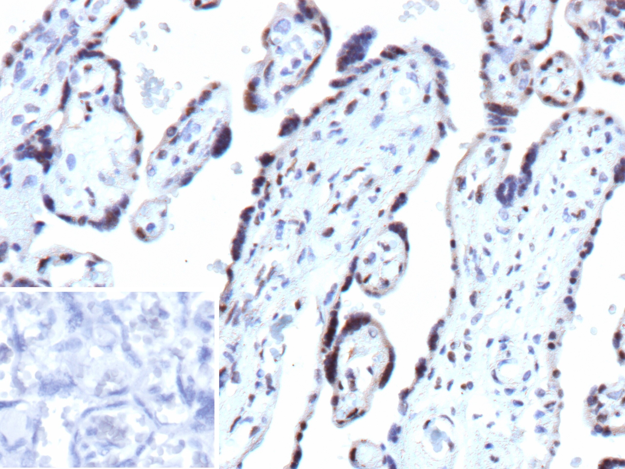 p27/Kip1 Antibody (rCDKN1B/13245) - Azide and BSA Free