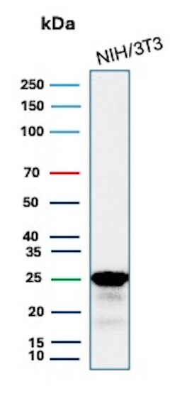 p27/Kip1 Antibody (KIP1/1355R) - Azide and BSA Free