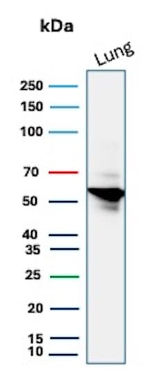 Serpin A1/alpha 1-Antitrypsin Antibody (AAT/3167R) - Azide and BSA Free