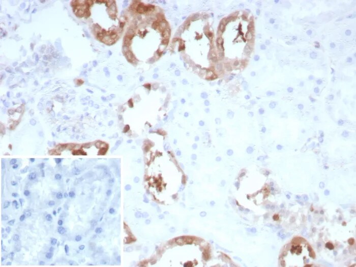 Creatine Kinase BB Antibody (rCKBB/8839) - Azide and BSA Free
