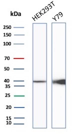 Creatine Kinase BB Antibody (rCKBB/8839) - Azide and BSA Free
