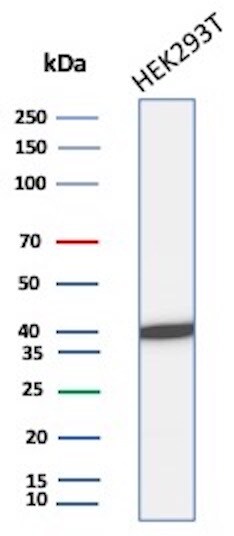 Creatine Kinase BB Antibody (rCKBB/8841) - Azide and BSA Free