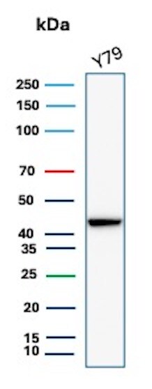 Creatine Kinase BB Antibody (rCKBB/8841) - Azide and BSA Free
