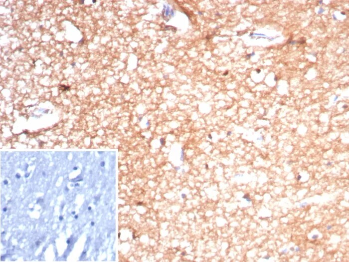 Creatine Kinase BB Antibody (rCKBB/8842) - Azide and BSA Free