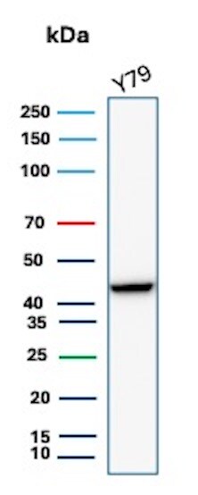 Creatine Kinase BB Antibody (rCKBB/8842) - Azide and BSA Free