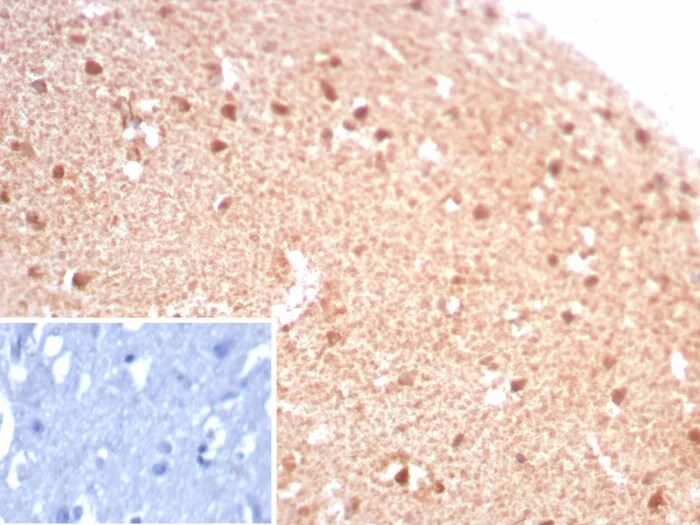 Creatine Kinase BB Antibody (rCKBB/8844) - Azide and BSA Free