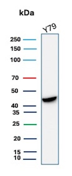 Creatine Kinase BB Antibody (rCKBB/8844) - Azide and BSA Free