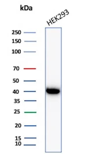 Creatine Kinase BB Antibody (CKBB/8306R) - Azide and BSA Free