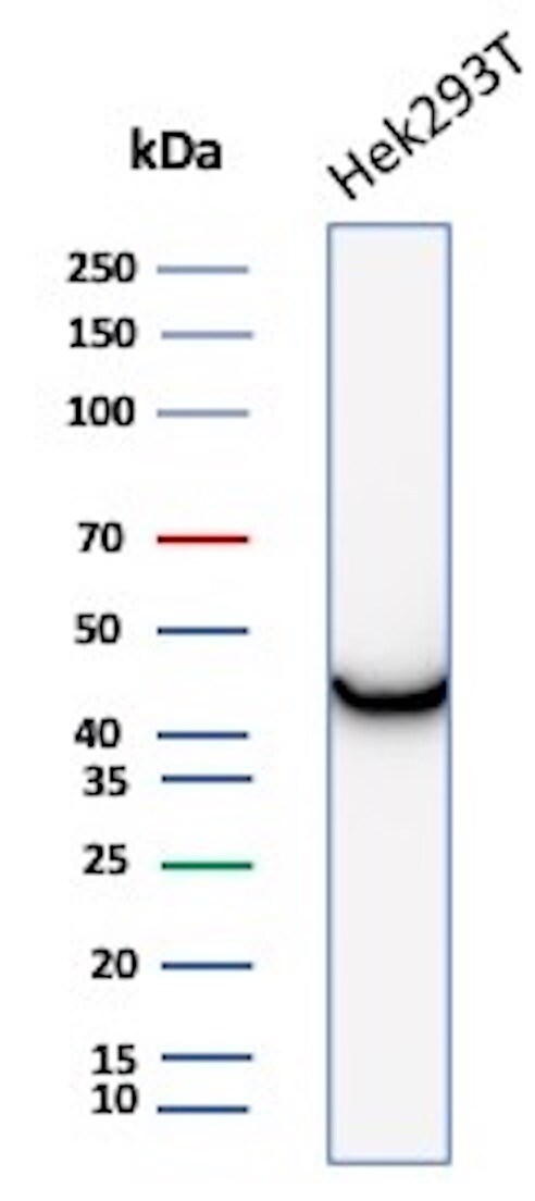 Creatine Kinase BB Antibody (CKBB/8306R) - Azide and BSA Free