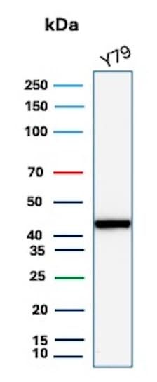 Creatine Kinase BB Antibody (CKBB/8306R) - Azide and BSA Free