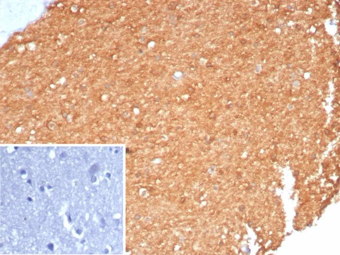 Creatine Kinase BB Antibody (CKBB/8310R) - Azide and BSA Free