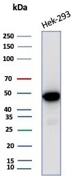 Creatine Kinase BB Antibody (CKBB/8310R) - Azide and BSA Free