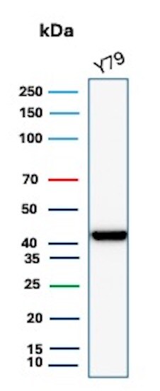 Creatine Kinase BB Antibody (CKBB/8310R) - Azide and BSA Free