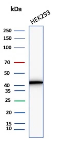 Creatine Kinase BB Antibody (CKBB/8310R) - Azide and BSA Free