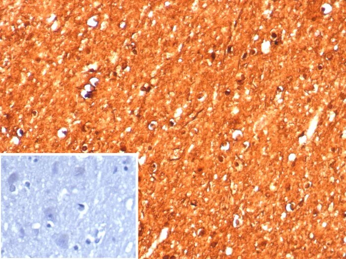Creatine Kinase BB Antibody (CKBB/8608R) - Azide and BSA Free
