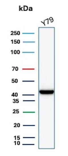 Creatine Kinase BB Antibody (CKBB/8608R) - Azide and BSA Free