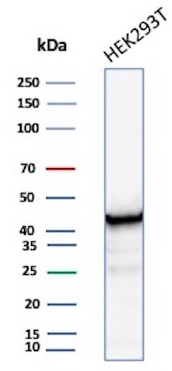 Creatine Kinase BB Antibody (CKBB/8608R) - Azide and BSA Free