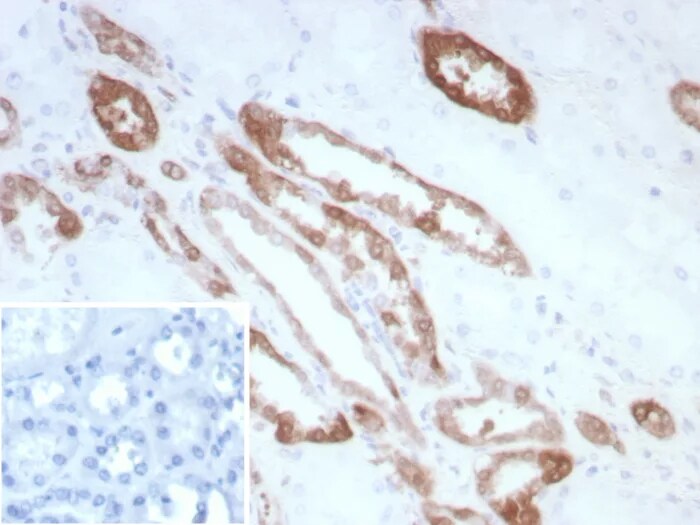 Creatine Kinase BB Antibody (CKBB/8840R) - Azide and BSA Free