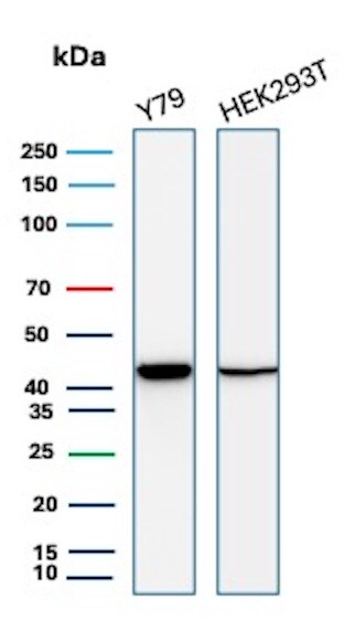 Creatine Kinase BB Antibody (CKBB/8840R) - Azide and BSA Free