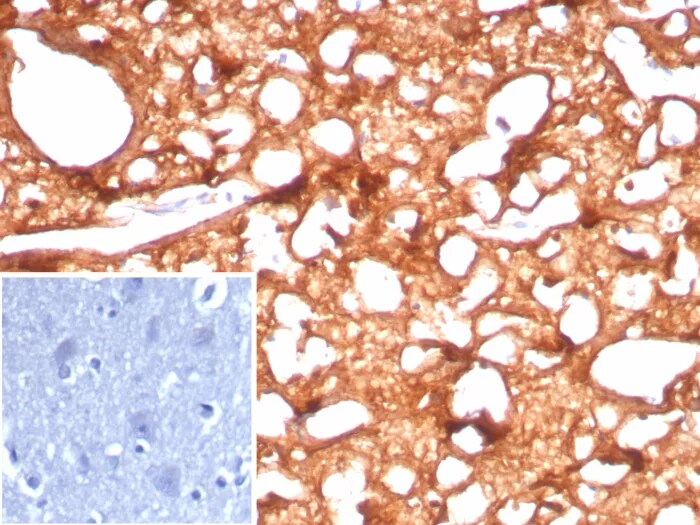 Creatine Kinase BB Antibody (CKBB/8843R) - Azide and BSA Free