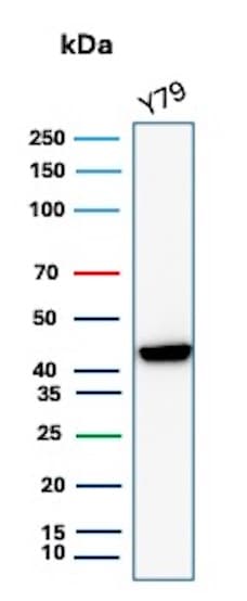 Creatine Kinase BB Antibody (CKBB/8843R) - Azide and BSA Free