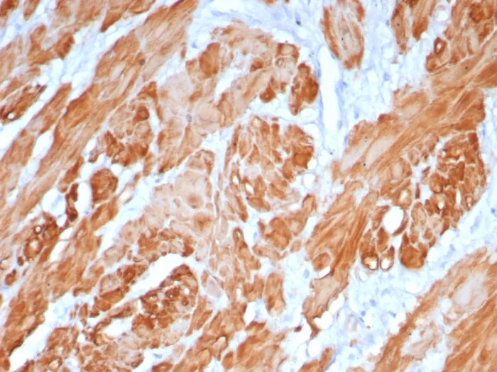 Calponin 1 Antibody (rCNN1/6918) - Azide and BSA Free