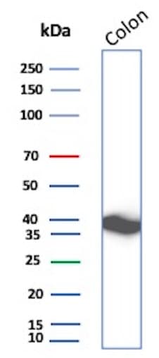 Calponin 1 Antibody (rCNN1/6918) - Azide and BSA Free