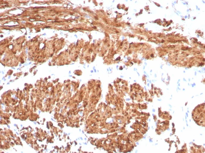 Calponin 1 Antibody (CNN1/8870R) - Azide and BSA Free