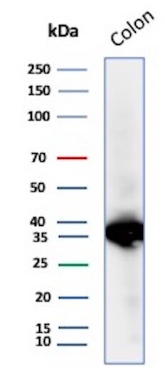 Calponin 1 Antibody (CNN1/8870R) - Azide and BSA Free