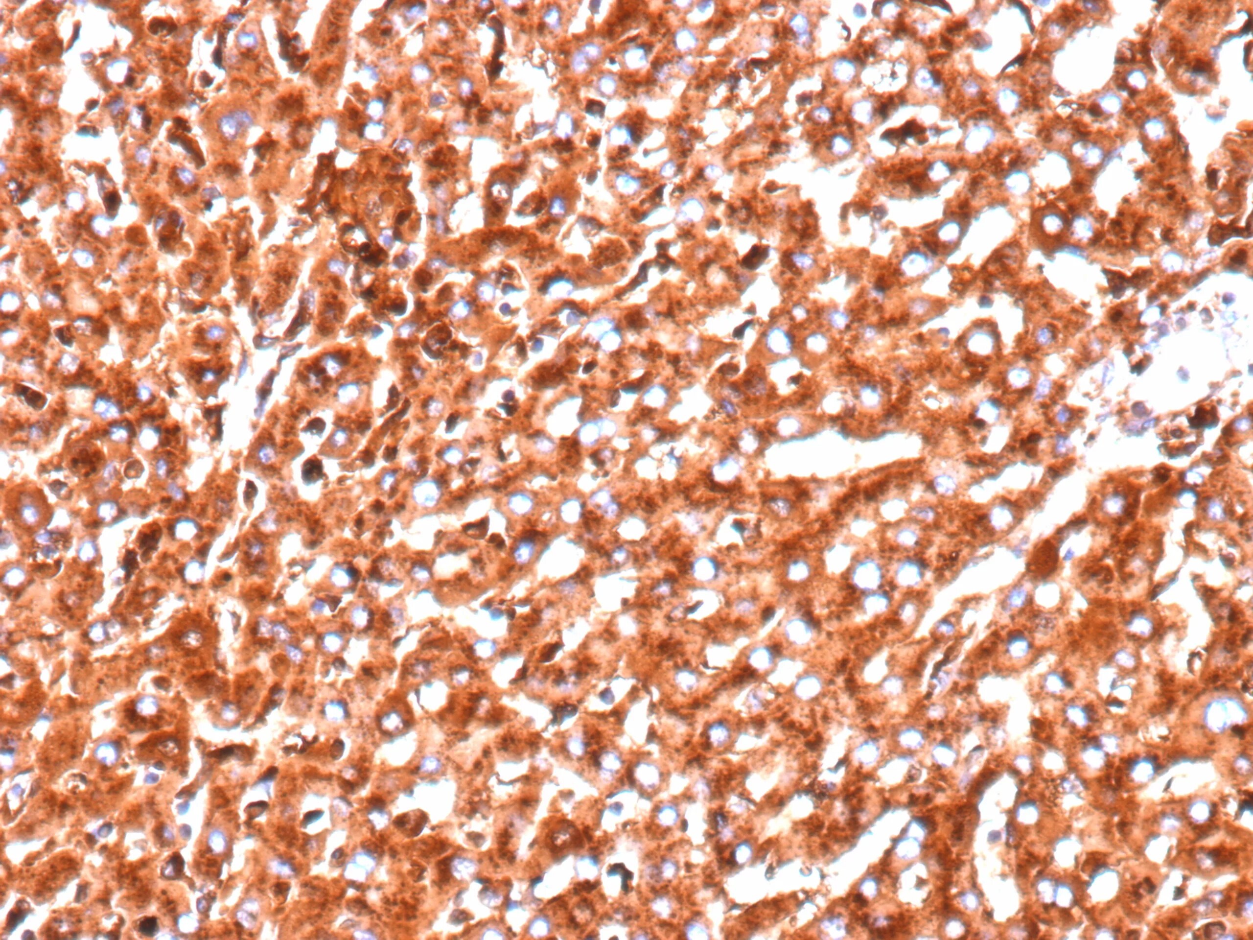Cathepsin D Antibody (CTSD/9613R) - Azide and BSA Free