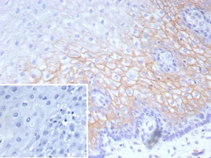 Desmocollin-2 Antibody (DSC2/9165R) - Azide and BSA Free