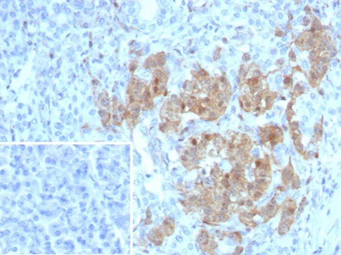 Enolase 2/Neuron-specific Enolase Antibody (ENO/8253R) - Azide and BSA Free